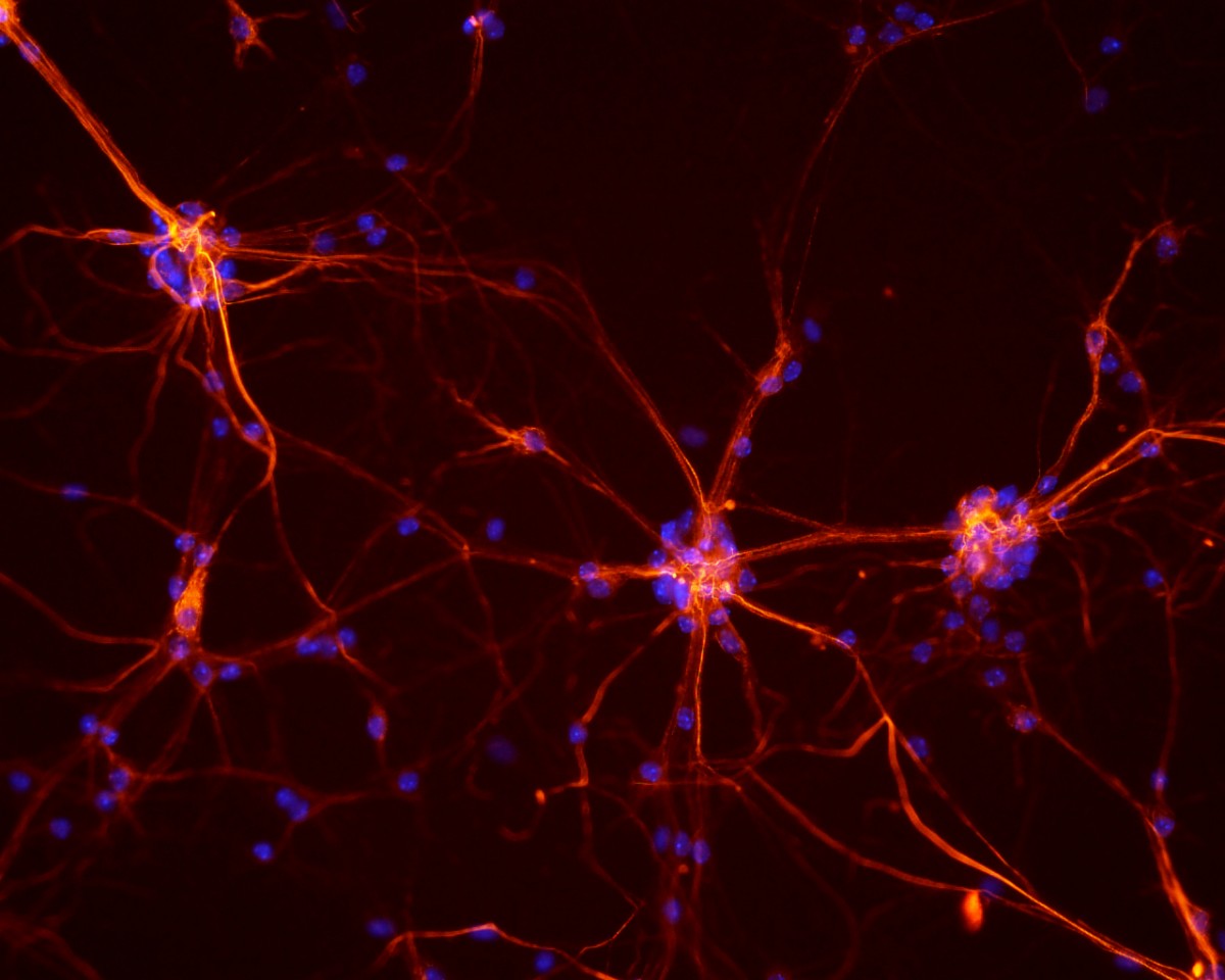 Brain-derived neurotropic factor